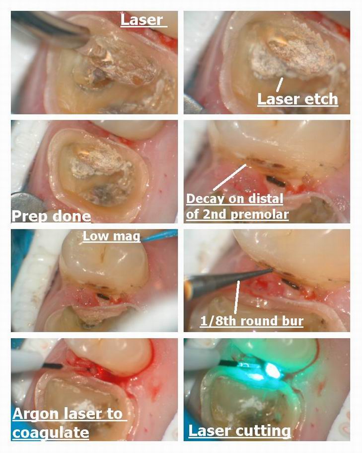 Resize of Pg 3 of crown prep.jpg